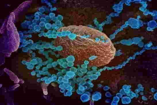 Le coronavirus pourrait voyager jusqu’à 4 mètres d’un malade