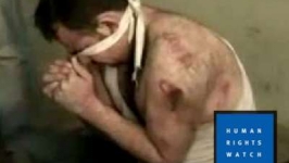 هيومن رايتس: 20 أسلوب تعذيب موثقا في معتقلات سوريا