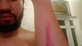 Un jeune journaliste brutalisé dans un commissariat à Annaba